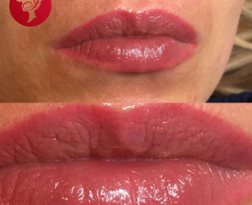 Lūpų permanentinis makiažas - Ilgalaikis makiažas Klaipėda Studija Ingida Permanent - 4