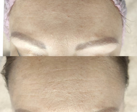 Kosmetologė / Taisija Štrois / Darbų pavyzdys ID 2083474