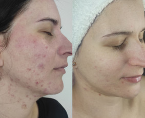 Kosmetologė / Taisija Štrois / Darbų pavyzdys ID 2085222