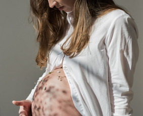 Fotografija - Nėščiosios fotosesija - 2 Nėščiosios fotosesija - Fotografija - 2