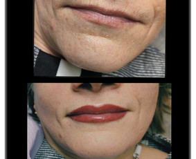 Kosmetologė Irina - Mikropigmentacija - 3 Mikropigmentacija - Kosmetologė Irina - 3