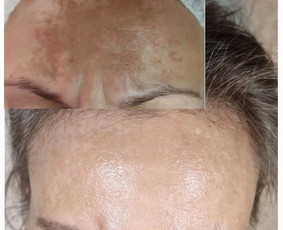 Kosmetologė / Taisija Štrois / Darbų pavyzdys ID 2538796