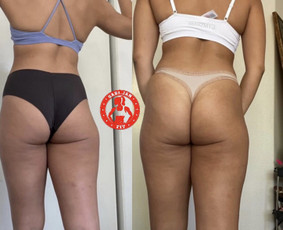 Pt Online Coaching / Gabija Janusaite / Darbų pavyzdys ID 2639112