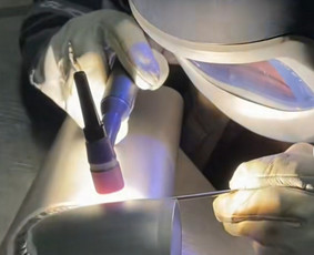 Suvirinimo paslaugos Aliuminis, Tig,mig/mag,mma - Laiptų montavimas - 1 Laiptų montavimas - Suvirinimo paslaugos Aliuminis, Tig,mig/mag,mma - 1