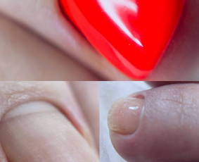 Pedikiūras - Manikiūras, gelinis lakavimas, pedikiūras, antakių korekcija - 1