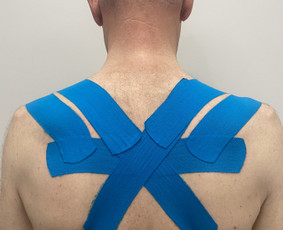 Individuali kineziterapija, manualinė terapija Kaune - Kineziologinis teipavimas - 1 Kineziologinis teipavimas - Individuali kineziterapija, manualinė terapija Kaune - 1