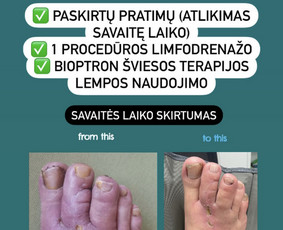 Individuali kineziterapija, manualinė terapija Kaune / Judesio Dirbtuvės Kineziterapijos Studija / Darbų pavyzdys ID 2947356