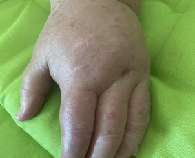 Individuali kineziterapija, manualinė terapija Kaune / Judesio Dirbtuvės Kineziterapijos Studija / Darbų pavyzdys ID 2985288