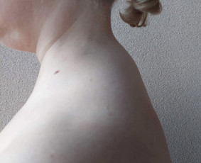 Individuali kineziterapija, manualinė terapija Kaune / Judesio Dirbtuvės Kineziterapijos Studija / Darbų pavyzdys ID 2985290