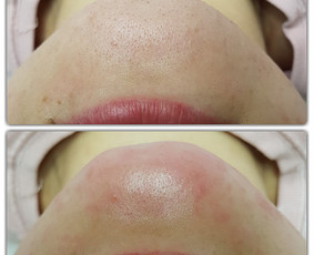 Kosmetologė Klaipėdoje / Jolita / Darbų pavyzdys ID 563373