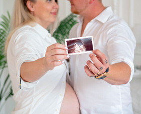 laukimas nestumo fotosesija kaune