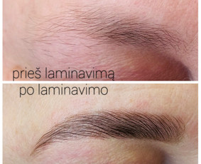 Antakių laminavimo procedūra