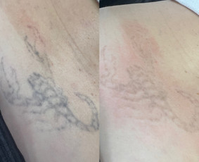 Permanentinis makiažas / Sandra Šalmin Permanent Makeup Academy / Darbų pavyzdys ID 3337587