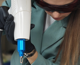 antakių, mini tattoo naikinimas, pigmento blukinimas šviesinimas, LA-Vi estetika