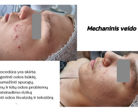 Kosmetologė / Taisija Štrois / Darbų pavyzdys ID 3344210