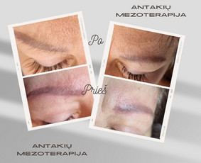 Kosmetologė / Taisija Štrois / Darbų pavyzdys ID 3374834