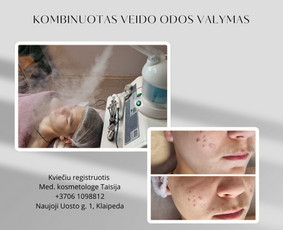 Kosmetologė - Mechaninis veido valymas - 2 Mechaninis veido valymas - Kosmetologė - 2