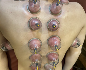 Sporto kineziterapija - Kineziterapeutas į namus. Individuali kineziterapija - 2