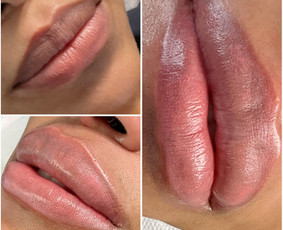 Abart - Lūpų permanentinis makiažas - 3 Lūpų permanentinis makiažas - Abart - 3