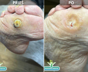 Privačios klinikos - Problematiškų nagų, pėdų pedikiūras į namus. - 3