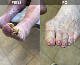 Privačios klinikos - Problematiškų nagų, pėdų pedikiūras į namus. - 2