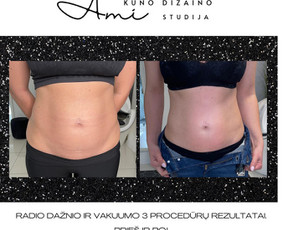 Ami - kūno dizaino studija Tauragėje / MB Ami kūno dizaino studija / Darbų pavyzdys ID 3614109