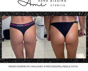 Ami - kūno dizaino studija Tauragėje / MB Ami kūno dizaino studija / Darbų pavyzdys ID 3614119