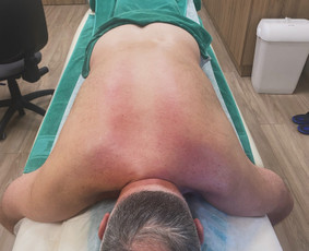 Gydomasis viso kūno masažas - Anticeliulitinis masažas - 2 Anticeliulitinis masažas - Gydomasis viso kūno masažas - 2