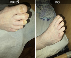 Probleminių nagų, padų, nuospaudų,varkymas jūsų namuose / Aida / Darbų pavyzdys ID 3679957