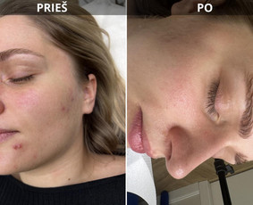 Odos priežiūra iš vidaus ir išorės / Med. kosmetologė Laura / Darbų pavyzdys ID 3690171