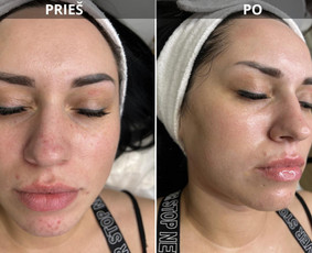 Odos priežiūra iš vidaus ir išorės / Med. kosmetologė Laura / Darbų pavyzdys ID 3690173
