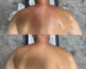 Masažas - Gydomasis masažas - 4 Gydomasis masažas - Masažas - 4