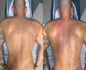 Masažas - Gydomasis masažas - 3 Gydomasis masažas - Masažas - 3