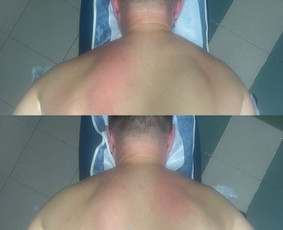 Trigerinių taškų masažas - Masažas - 4