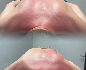 Trigerinių taškų masažas - Masažas - 2