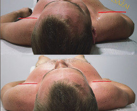 Trigerinių taškų masažas - Masažas - 1