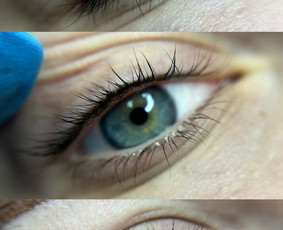 Ilgalaikis makiažas – tobulas grožis be pastangų! - Akių permanentinis makiažas - 4 Akių permanentinis makiažas - Ilgalaikis makiažas – tobulas grožis be pastangų! - 4