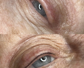 Ilgalaikis makiažas – tobulas grožis be pastangų! - Akių permanentinis makiažas - 3 Akių permanentinis makiažas - Ilgalaikis makiažas – tobulas grožis be pastangų! - 3