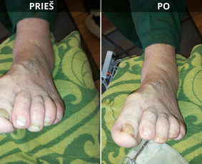 Probleminių nagų, padų, nuospaudų,varkymas jūsų namuose / Aida / Darbų pavyzdys ID 3752189