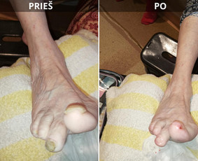Probleminių nagų, padų, nuospaudų,varkymas jūsų namuose / Aida / Darbų pavyzdys ID 3768315