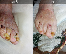 Probleminių nagų, padų, nuospaudų,varkymas jūsų namuose / Aida / Darbų pavyzdys ID 3793042
