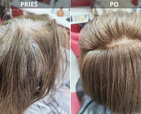 Plaukų tonavimas - Vyrų moterų Kirpykla Žanlisa &Scaron;iauliuose - 3