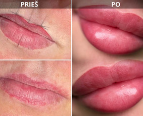 Permanentinis makiažas Vilniuje Justiniškėse - Lūpų permanentinis makiažas - 2 Lūpų permanentinis makiažas - Permanentinis makiažas Vilniuje Justiniškėse - 2