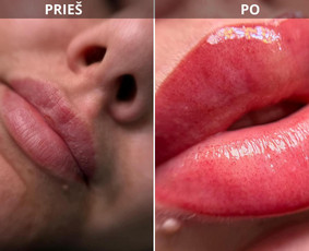 Permanentinis makiažas Vilniuje Justiniškėse - Lūpų permanentinis makiažas - 1 Lūpų permanentinis makiažas - Permanentinis makiažas Vilniuje Justiniškėse - 1