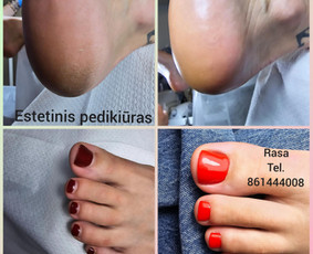 Probleminių pėdų sprendimai - Pedikiūras - 2 Pedikiūras - Probleminių pėdų sprendimai - 2