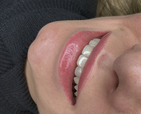 Natūraliai atrodantis ilgalaikis makiažas. Antakių korekcija - Lūpų permanentinis makiažas - 2 Lūpų permanentinis makiažas - Natūraliai atrodantis ilgalaikis makiažas. Antakių korekcija - 2