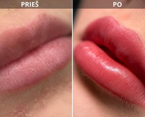 Antakių ir lūpų permanentinis makiažas - Lūpų permanentinis makiažas - 3 Lūpų permanentinis makiažas - Antakių ir lūpų permanentinis makiažas - 3