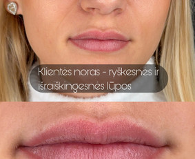 Lūpų permanentinis makiažas - Antakių ir lūpų permanentinis makiažas - 2
