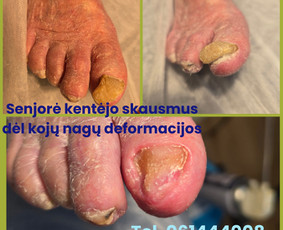 Probleminių pėdų sprendimai - Manikiūras - 1 Manikiūras - Probleminių pėdų sprendimai - 1