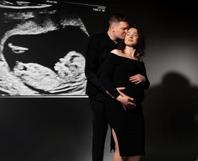 Vestuvės/ Asmeninės fotosesijos/ Krikštynos/ Naujagimiai / Benita Srebaliute / Darbų pavyzdys ID 3942070